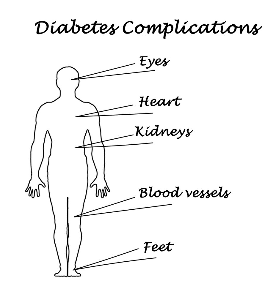 Complications Diabetes Ireland Diabetes Ireland