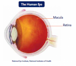 Retinopathy Image